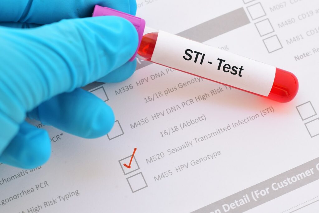 Confidential STI Testing & Support - Dr Sandar