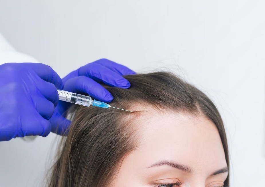 PRP for Hair Loss - Dr. Sandar