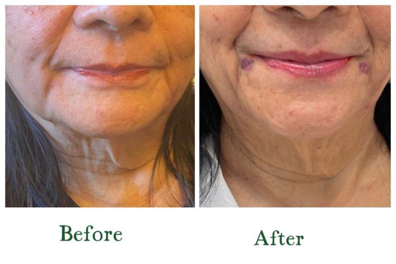 Personalised Aesthetic Treatment by Dr Sandar